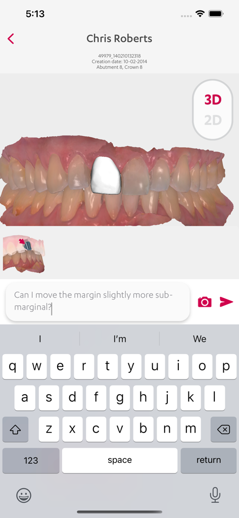 A 3D dental scan of a patient's teeth showing a crown design with a chat interface for professional feedback.