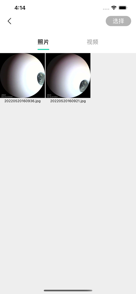 Visual ear spoon - Photo gallery screen in the Visual ear spoon app showing captured ear canal inspection images.