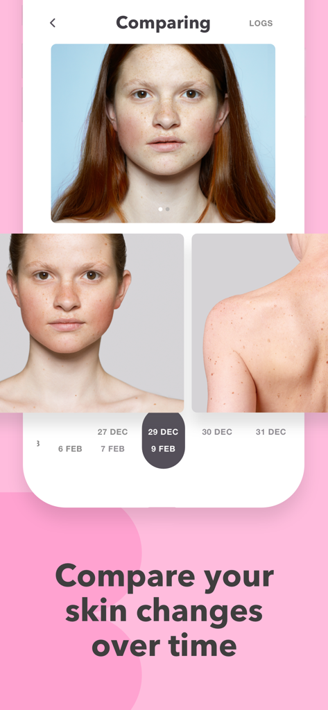 Skincare Routine: BasicBeauty - A comparison screen in the BasicBeauty app showing photos of skin changes on the face and back over time.