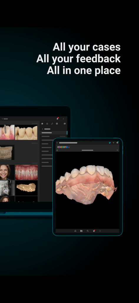 Smilecloud app interface on iPad showing a collection of dental patient cases and 3D scans
