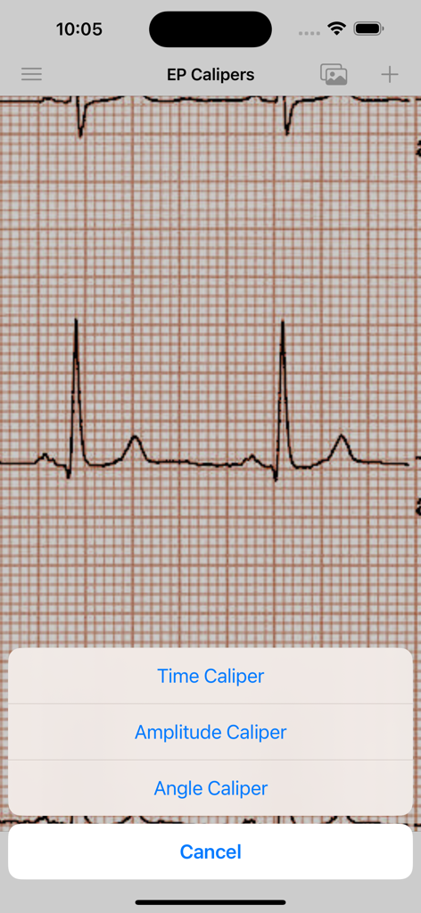 EP Calipers menu with time amplitude and angle measurement options over an ECG image