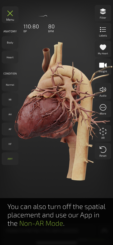 INSIGHT HEART - A detailed 3D anatomical model of the human heart in the INSIGHT HEART app interface showing medical conditions and anatomical filters.
