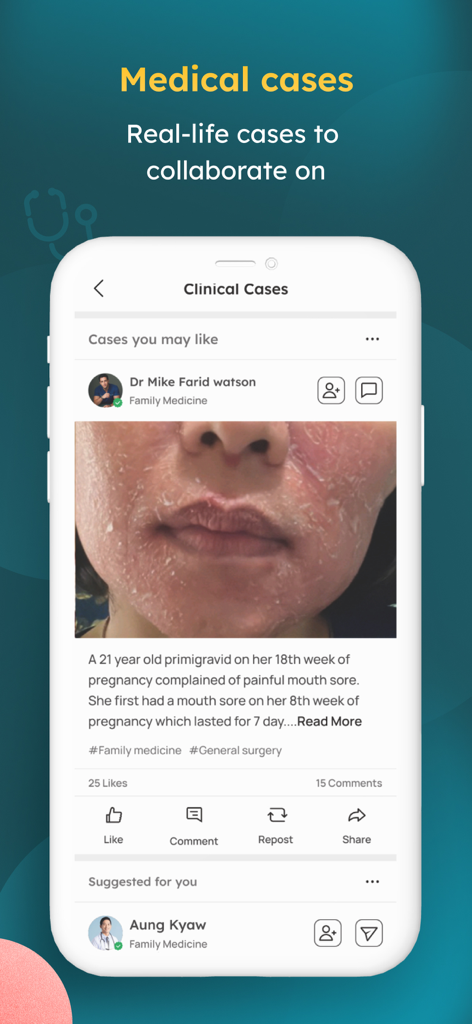 Docquity - Interface of the Docquity app showing a clinical case feed where healthcare professionals collaborate on real life medical cases