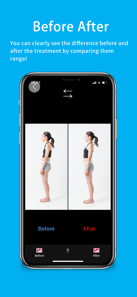 Grid line shoot  APP Pro - Side by side postural analysis showing before and after treatment results