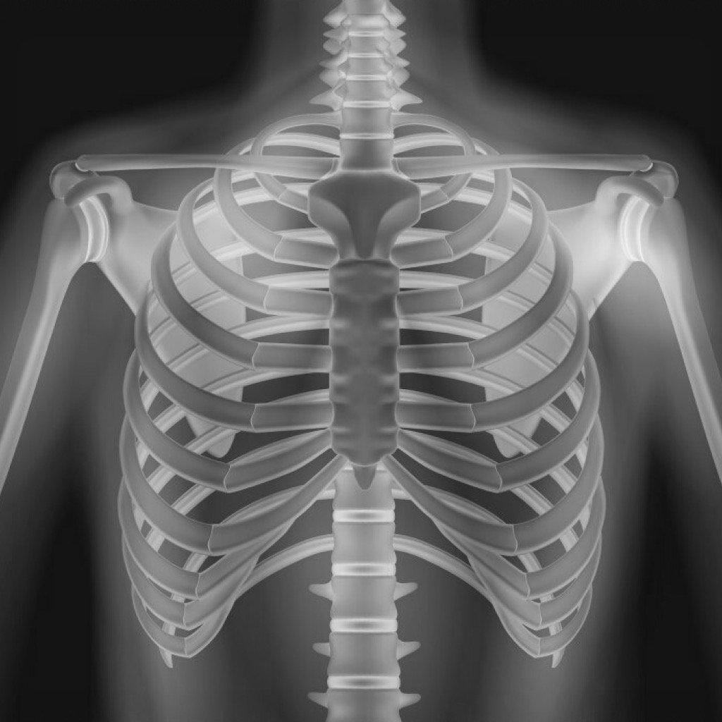 XRay - Sublux Anatomy Learning - Medical App | MWM