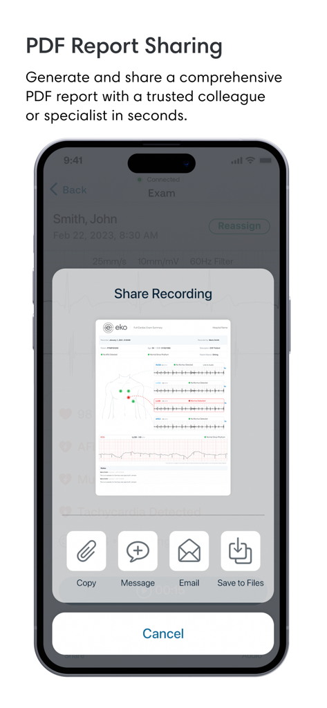 Screenshot of the Eko app showing the PDF report sharing feature with a preview of a medical report including ECG waveforms and heart sound diagrams