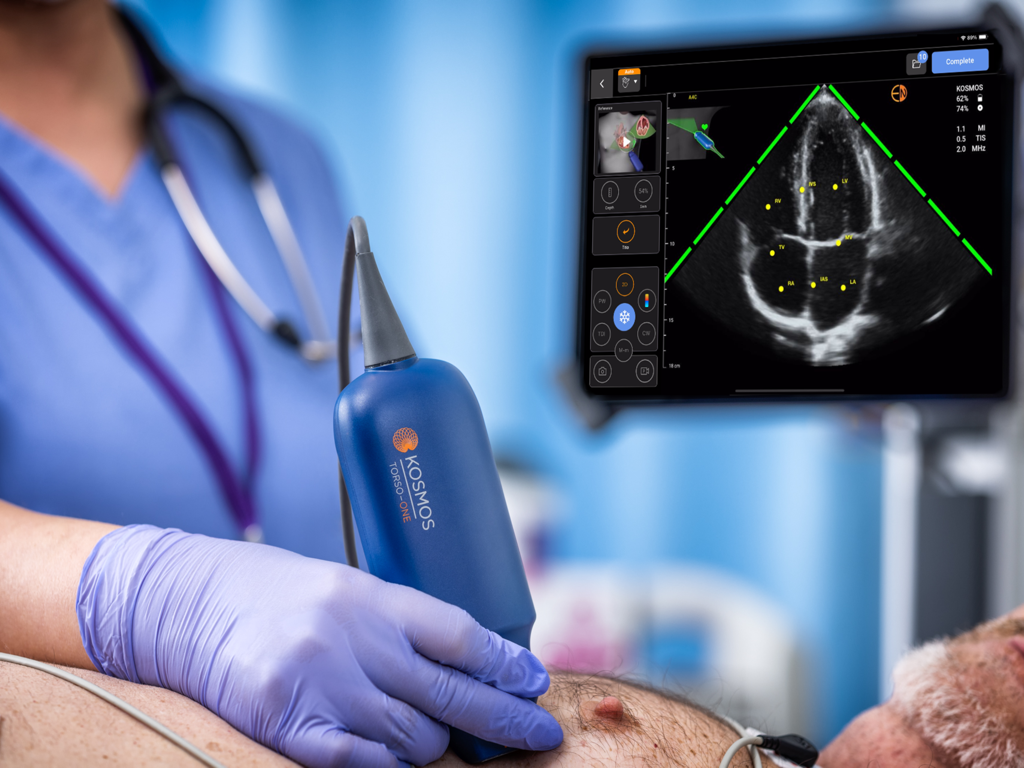 Kosmos Ultrasound 4.0 - A clinician using the Kosmos handheld ultrasound probe for cardiac imaging displayed on an iPad