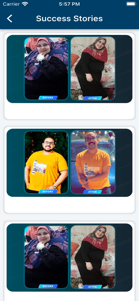 Sarhan Obesity Clinic - Resultados de pérdida de peso antes y después de pacientes de la Clínica Sarhan de Obesidad