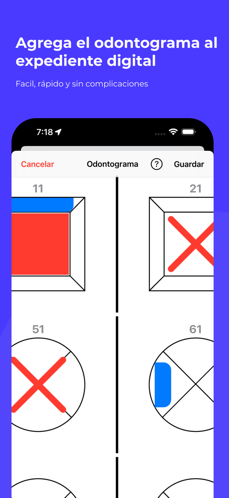 OneClick: Expedientes Dentales - Digital odontogram interface in the OneClick dental records app showing tooth charts with clinical markings.