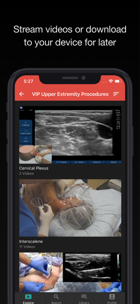 BLOCKJOCKS - Eine mobile Oberfläche für Blockjocks, die eine Liste von medizinischen Prozedurvideos für den oberen Extremitäten zeigt, die zum Streamen oder Herunterladen verfügbar sind.