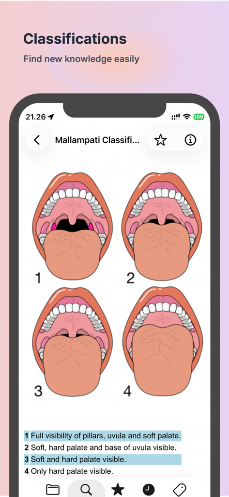 Écran d'une application médicale affichant la classification de Mallampati avec quatre schémas buccaux pour l'évaluation anesthésique