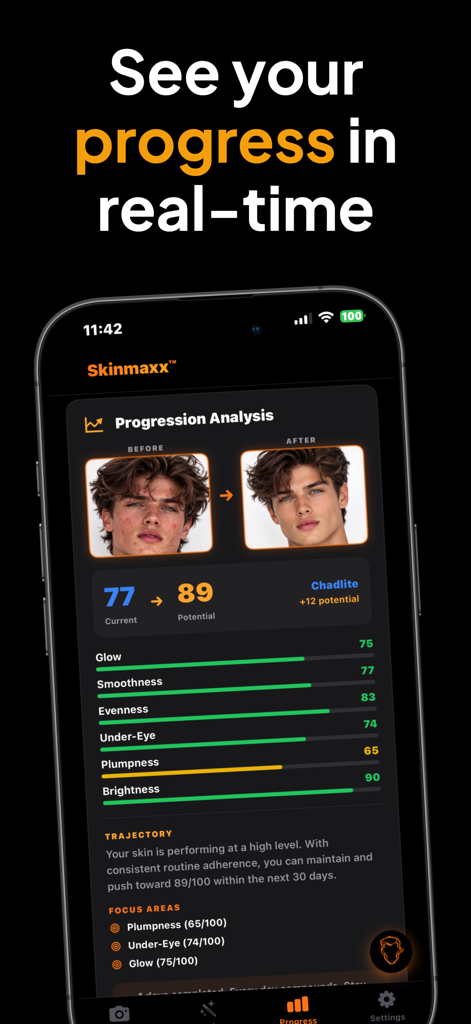 Skinmaxx - Get Scores & Ascend - Skinmaxx app progression analysis screen showing before and after skin results with AI health scores