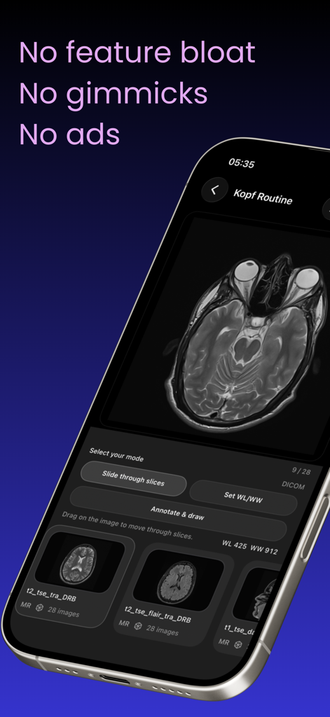 Dicom viewer MRI CT RX imaging - Resonancia magnética de cabeza mostrada en la interfaz de la aplicación móvil Visor Dicom con controles de visualización.