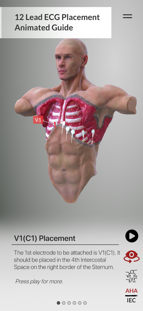 3D anatomical model showing correct V1 electrode placement for ECG