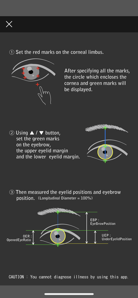 Eyelid - Step-by-step instructions for measuring eyelid and eyebrow positions including OER and EBP metrics