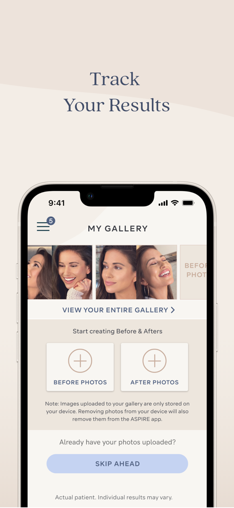 ASPIRE Galderma Rewards - Ein Screenshot der ASPIRE Galderma Rewards-App mit einer Vorher-Nachher-Galerie zur Verfolgung von Ergebnissen ästhetischer Behandlungen.