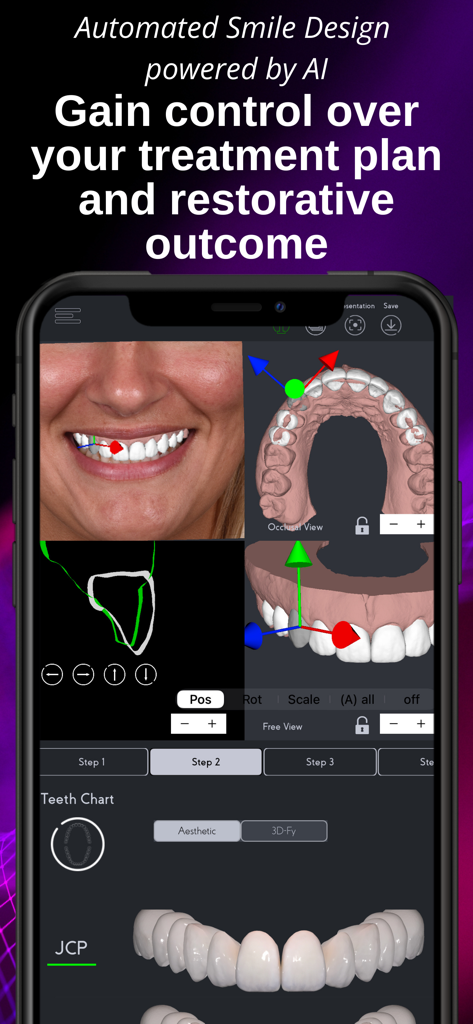 SmileFy TNG - Interfaz de la aplicación SmileFy TNG que muestra diseño de sonrisas 3D impulsado por IA y planificación de tratamientos dentales en un smartphone.
