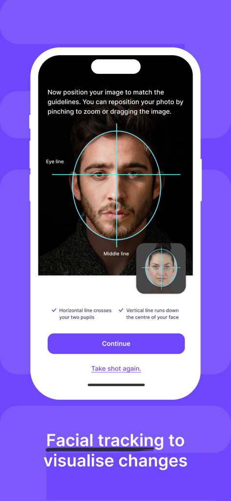 Mewing by Dr Mike Mew - A mobile interface from the Mewing app showing facial tracking guidelines used to align a photo for progress visualization.