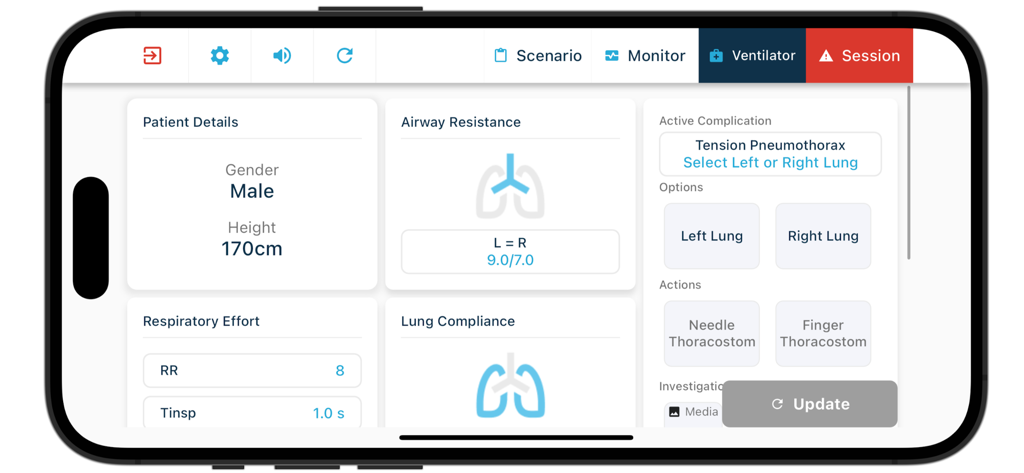 Interface of the TruMonitor app showing ventilator settings and active complication options for tension pneumothorax simulation.