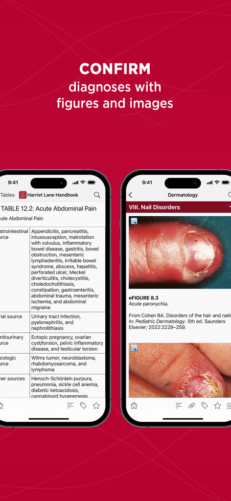 Harriet Lane Handbook - Two mobile screens from the Harriet Lane Handbook app showing a pediatric abdominal pain table and dermatology medical images.