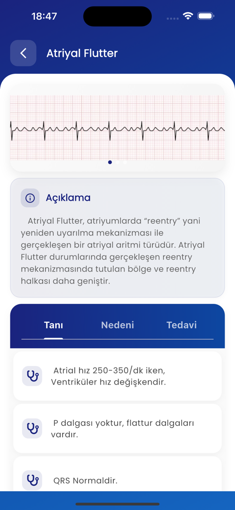 Oberfläche der mobilen App, die den Vorhofflimmern-EKG-Rhythmus und medizinische Diagnose Details anzeigt