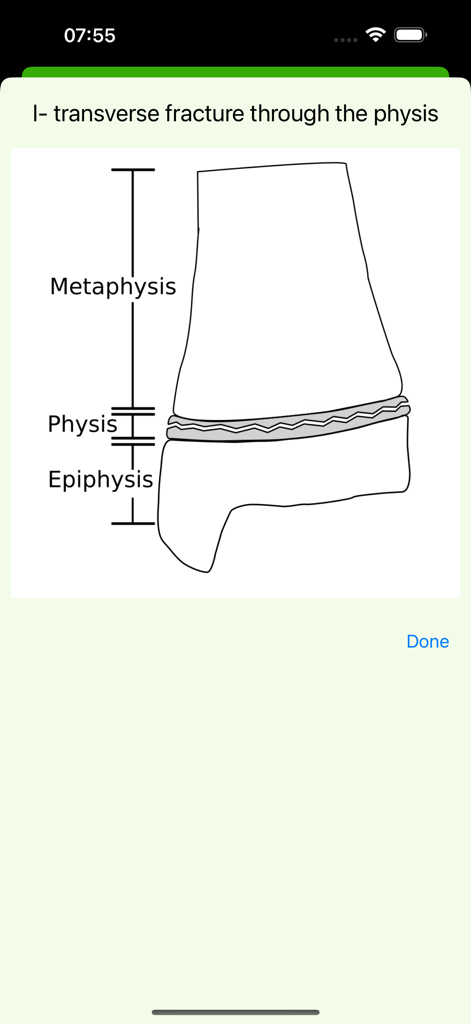 Diagrama médico de una fractura transversal a través de la fisis con etiquetas para metafisis y epifisis