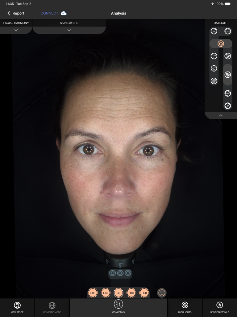 Alma IQ - Alma IQ professional skin analysis interface featuring a high resolution facial scan and diagnostic tools