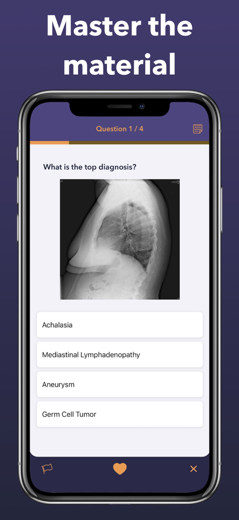 Radiology Board Review app interface featuring a chest X-ray diagnostic question