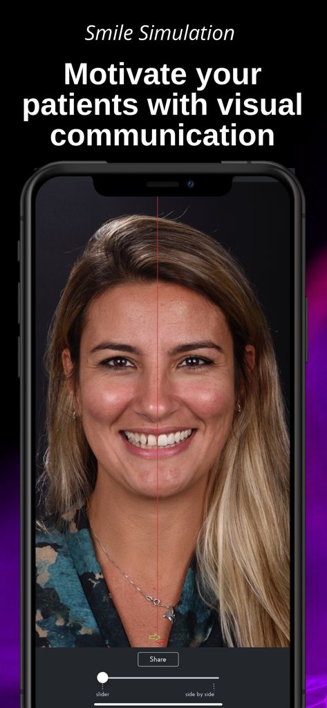 SmileFy TNG - Función de simulación de sonrisa en la aplicación SmileFy TNG para motivar a los pacientes dentales