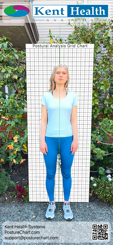 Posture Chart - A woman standing with a digital postural analysis grid chart overlay for alignment assessment