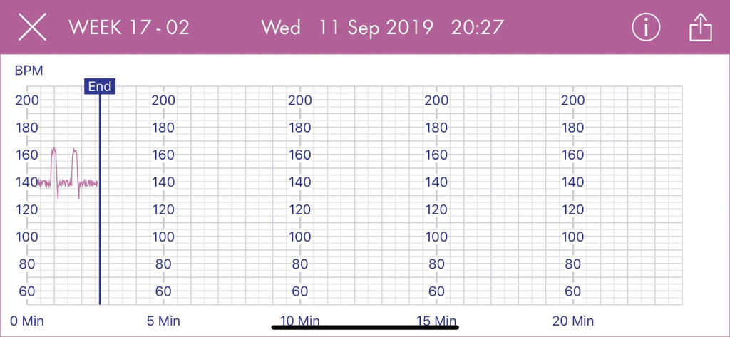HeraBEAT app screen showing a fetal heart rate graph with BPM measurements and pregnancy week tracking