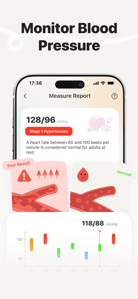 Una pantalla de aplicación móvil que muestra un informe de presión arterial con estado de Hipertensión Etapa 1 y un gráfico de tendencias semanal.