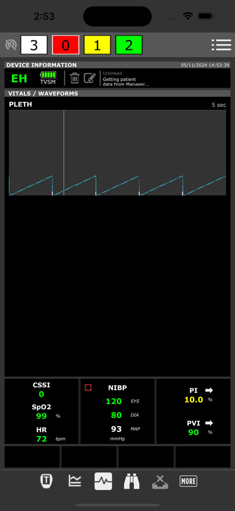 ADMS-App-Oberfläche, die Patienten-Vitaldaten und Plethysmographie-Kurven anzeigt.