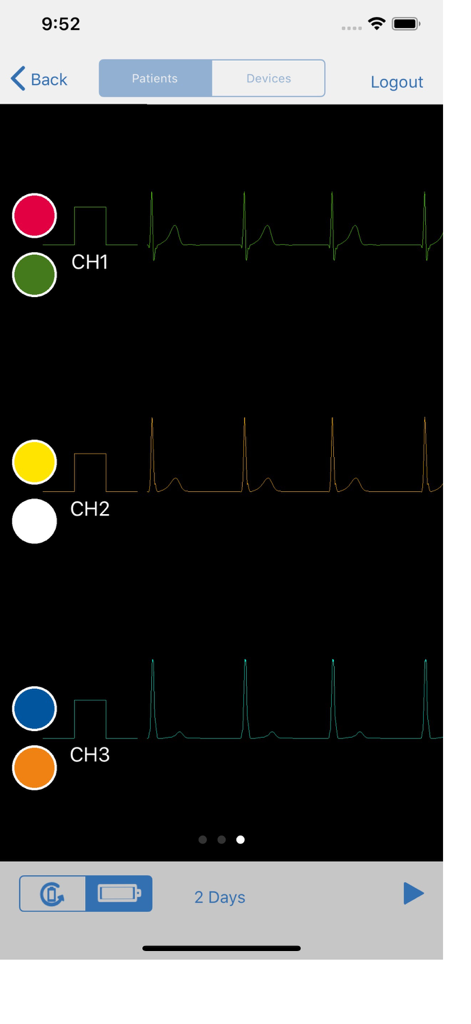 SEER Simulator - ECG waveform preview screen in the SEER Simulator app showing three signal channels.
