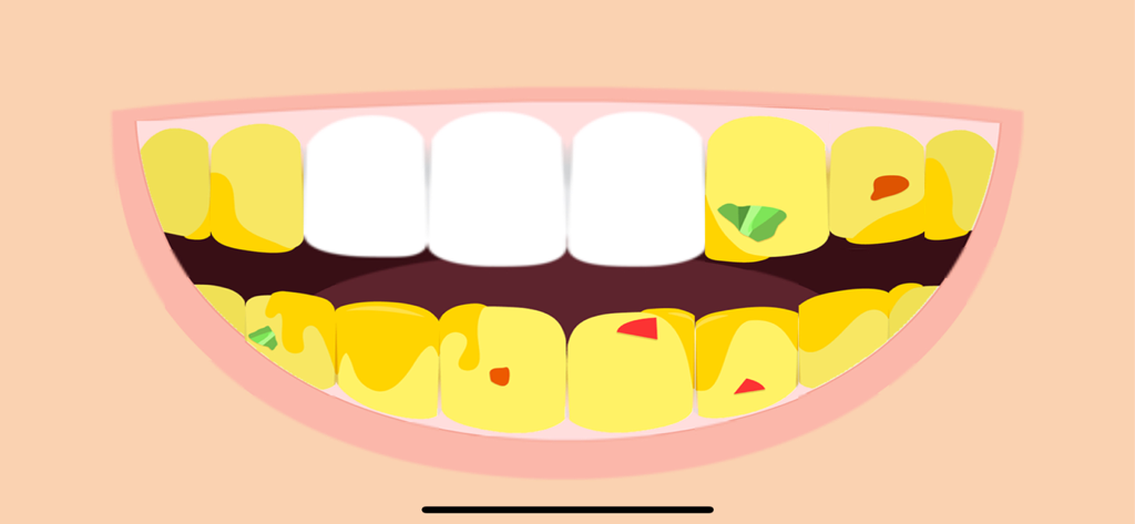 Daily Tasks - Una boca caricaturizada que muestra una comparación entre dientes amarillos sucios y dientes blancos limpios para una tarea de cepillado
