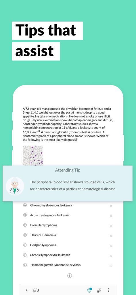 AMBOSS Qbank for Medical Exams - La aplicación AMBOSS Qbank mostrando una pregunta médica con una ventana emergente de pista de un Attending Tip.