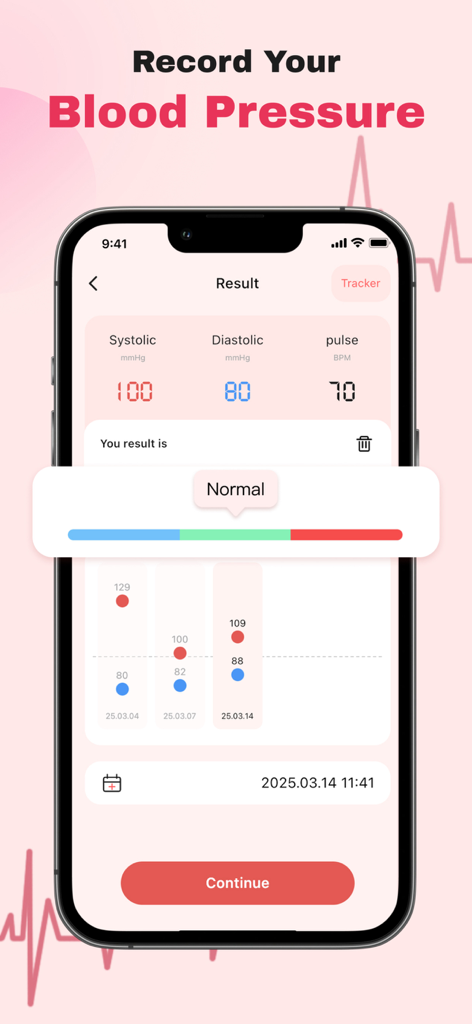 Blood Pressure APP-pulse track - Una interfaz móvil que muestra lecturas de presión arterial sistólica y diastólica con un gráfico de tendencias de salud
