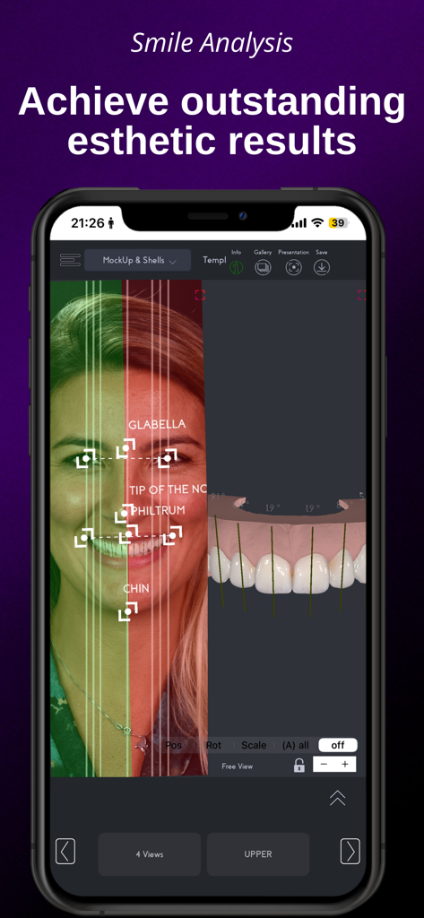 SmileFy TNG - Pantalla de la aplicación móvil SmileFy TNG que muestra el análisis de la sonrisa con mapeo de puntos de referencia faciales y un modelo dental 3D.