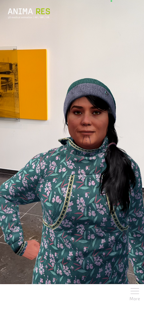 EpiBrain医療教育アプリ内のアラスカ先住民の女性の拡張現実ホログラム。