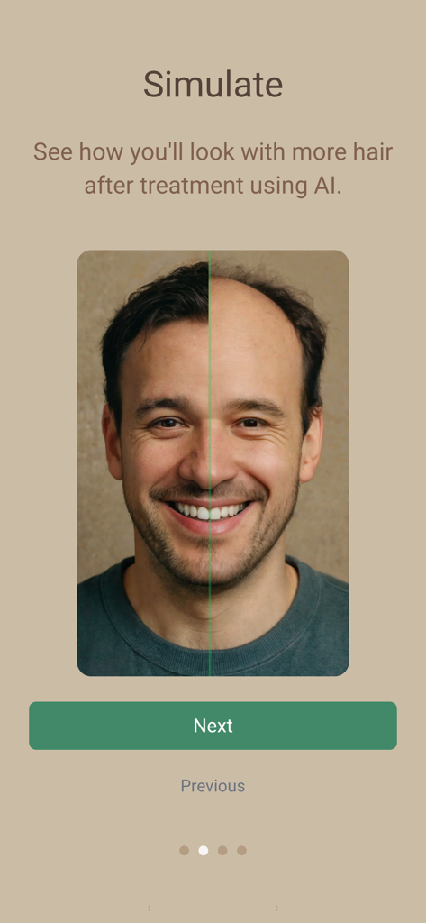 AI hair simulation showing before and after hair transplant results