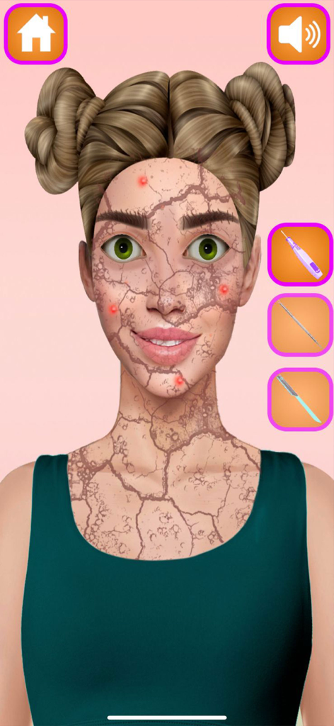 Halloween Makeup Salon Game - A character in the Halloween Makeup Salon Game with cracked skin and acne being treated with beauty tools
