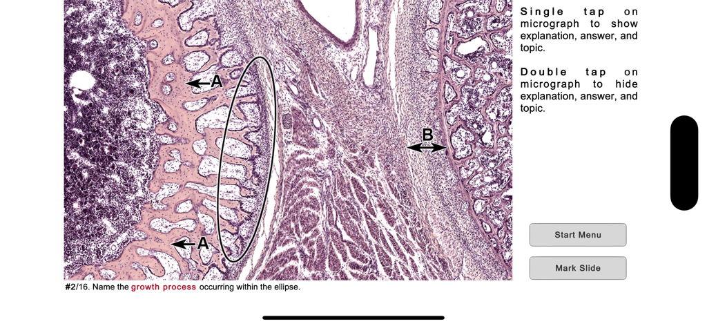 Histo! - Histologie-Quiz-Benutzeroberfläche mit einem mikroskopischen Präparat und einer Identifikationsfrage