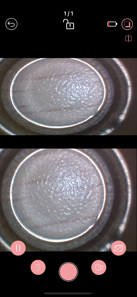 iTiMO - iTiMO app interface showing a split screen microscopic view of skin texture