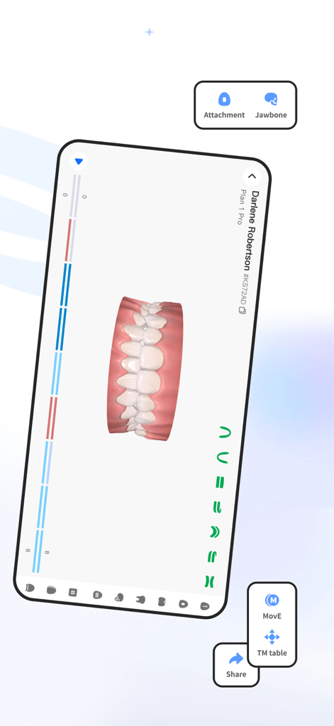 Visualizador 3D dentário mostrando um plano de tratamento de paciente na app Angel Aligner iOrtho