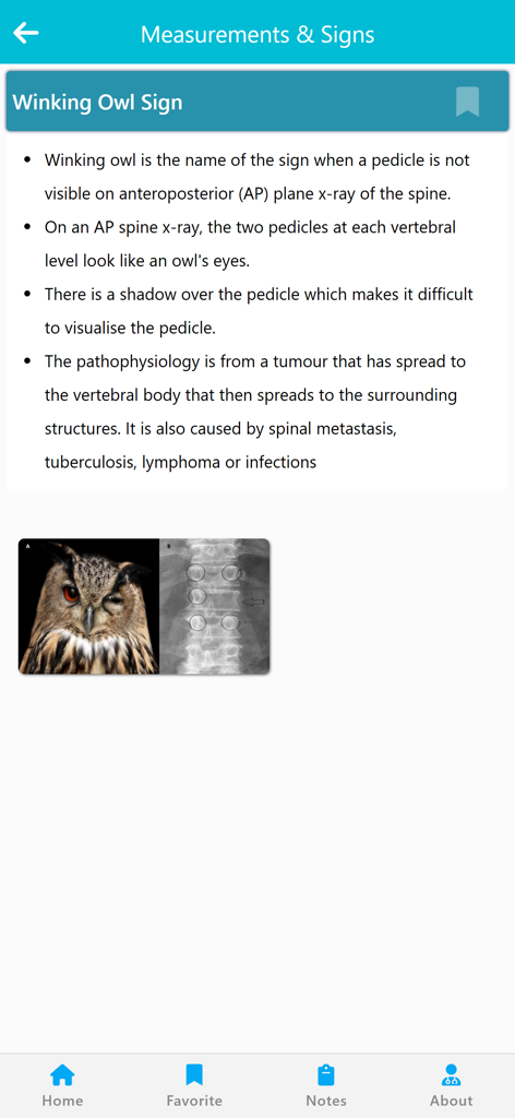 Orthopedic Signs & Angles - Medical App | MWM
