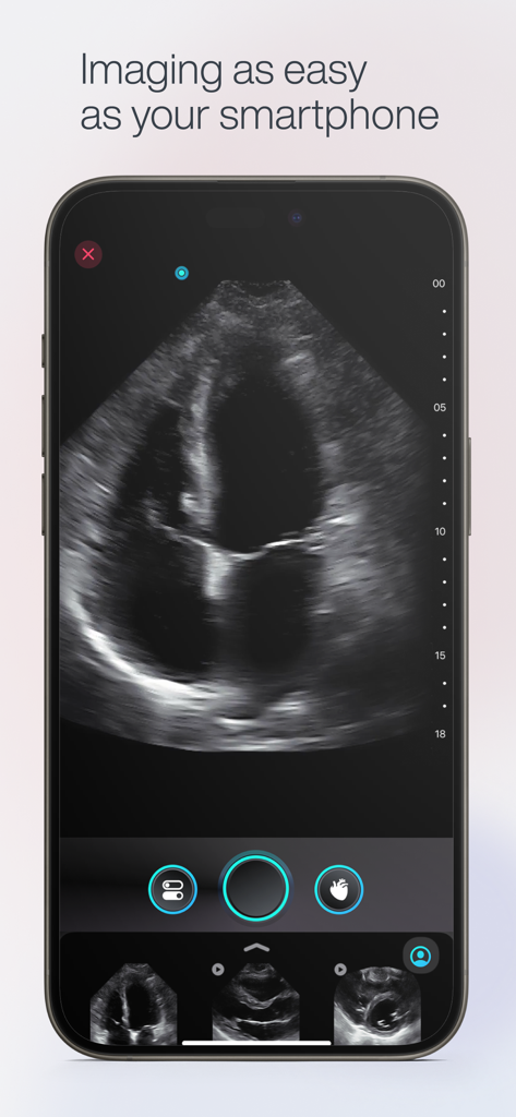 Exo Iris™ - Smartphone displaying a cardiac ultrasound scan on the Exo Iris app interface.