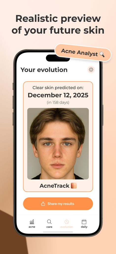 AcneTrack – Your Acne Journey - Schermata dello smartphone che mostra l'anteprima realistica della pelle futura dell'app AcneTrack e la data prevista di pelle pulita.