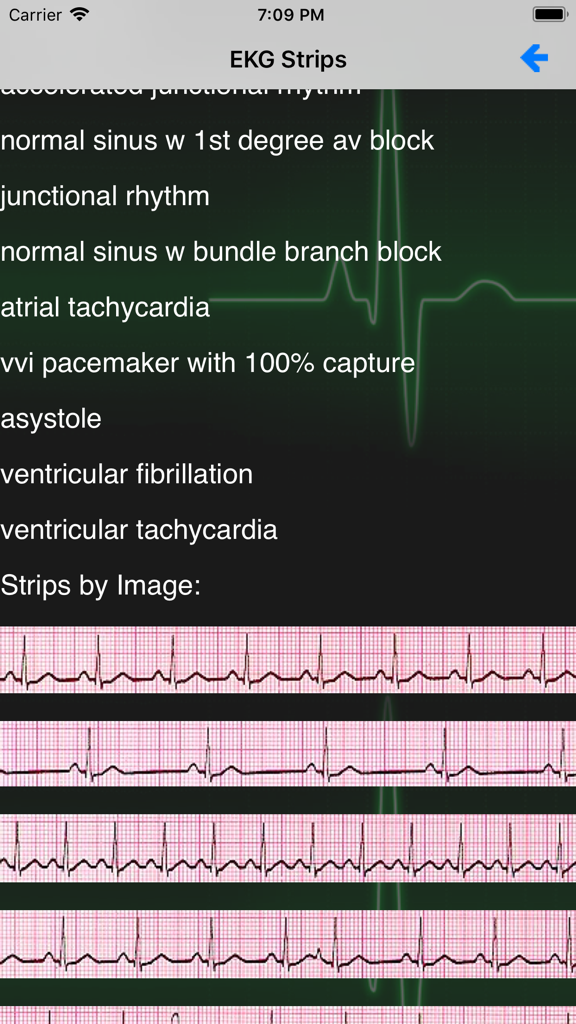 EKG Academy | Master EKG & ECG Interpretation