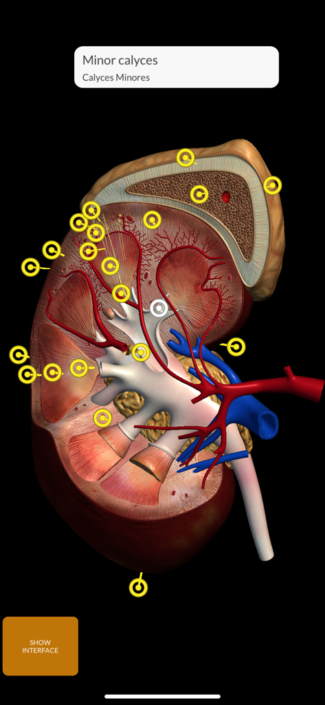 Detailed 3D cross-section of a human kidney with anatomical pins and labels for minor calyces