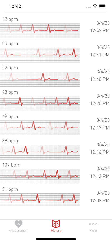 Pantalla de historial de la aplicación Cardiograph que muestra un registro de mediciones de frecuencia cardíaca con valores de LPM y gráficos de forma de onda